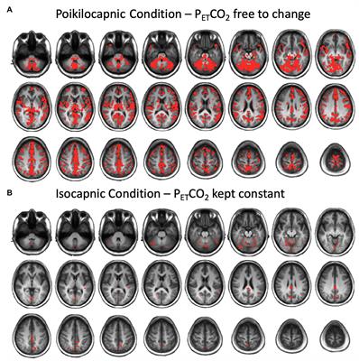 The Effect of CO2 on Resting-State Functional Connectivity: Isocapnia vs. Poikilocapnia